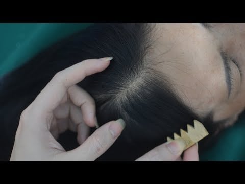 ASMR Real Person Head Scratching And Hair Parting With Hair Sounds For Headache Relief