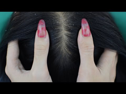 Asmr 1 Hour Scalp Treatment ( Scalp Check, Scalp Scratching, Scalp Massage ) Relaxing For Sleep