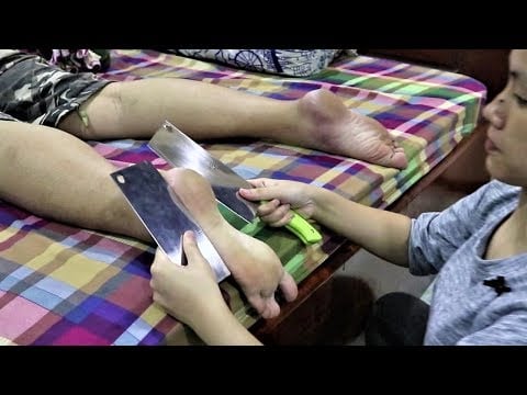 ASMR Relaxing Foot Massage by Emily ! Knife Foot Massage