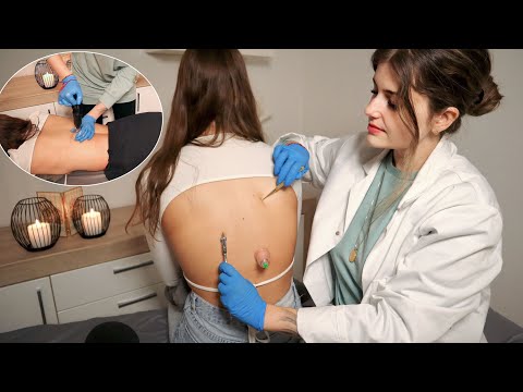 ASMR Chiropractic Back Exam | Acupoint & Cupping Massage 'Unintentional' Real Person Roleplay