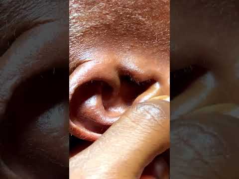 Ear Cleaning on a real person #asmr #tingling #sleepsounds #satisfying