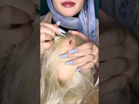 Bugs&Lice Plucking 🐜💆🏻‍♀️ #asmr #hair #visualtingle #asmrmassage #asmrscratching #shorts