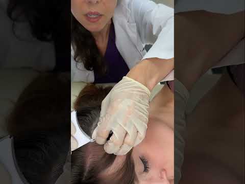 Asmr scalp tingles #asmr #asmrsounds #asmrvideo #relax #relaxing #satisfying #hair #sleep #tingles