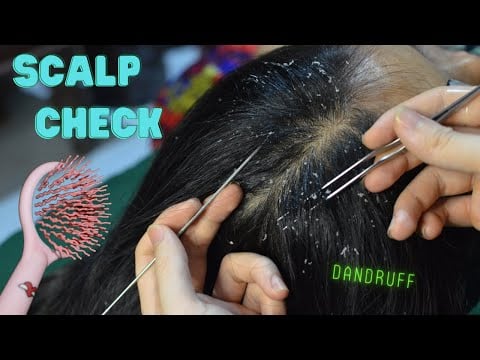 ASMR Up Close Attentive Scalp Check, Scalp Scratching,Scalp Picking On Real Person Relaxing To Sleep