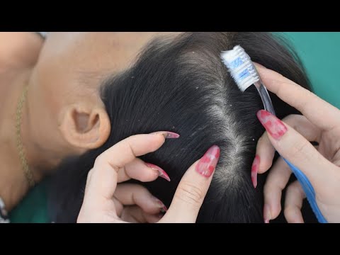 ASMR Hair Parting, Hair Massage, Head Massage On Real Person Make You Fall Asleep