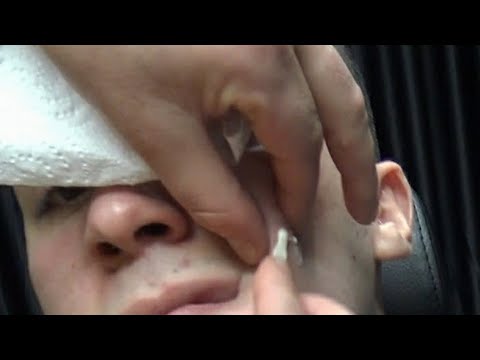 💈 ASMR BARBER 💈 SKIN CARE-EAR,NOSE WAX - EAR BURN - RAZOR BEARD SHAVE - CRACKS- BODY MASSAGE THERAPY