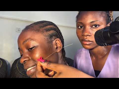 ASMR Deep Ear Cleaning ✨Ear Flossing, PimplePopping, Head Scratching & Ear Eating for Sleep