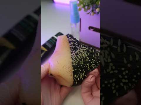 remoção de cravos satisfatória ASMR #asmr #cravos #blackheads #shorts
