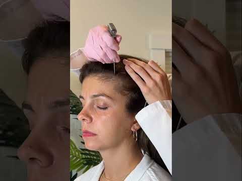 Asmr scalp tingles #asmr #asmrsounds #asmrvideo #relax #relaxing #satisfying #hair #sleep #tingles