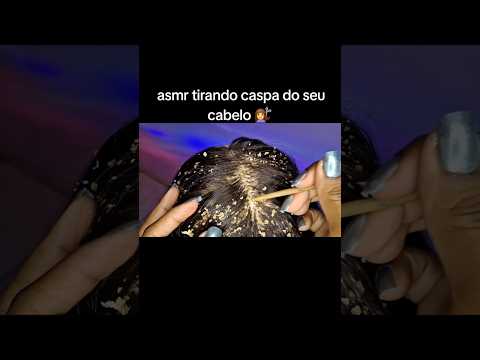 ASMR TIRANDO CASPA DO SEU CABELO NO MEU CONSULTÓRIO #asmr #shorts #shortvideo