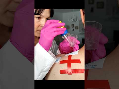 Skin test for potential allergies