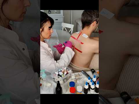 Prepare for allergy test