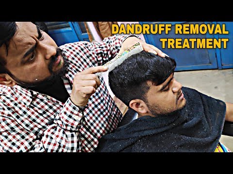 Dandruff removal asmr and hair treatment by biswajit barber | Indian barber Relaxing dandruff remove