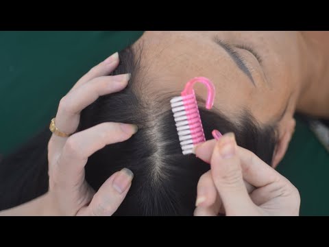 ASMR Aggressive Scalp Scratching Massage, Tingly Hair Sounds With Breathing Noise For Relaxation