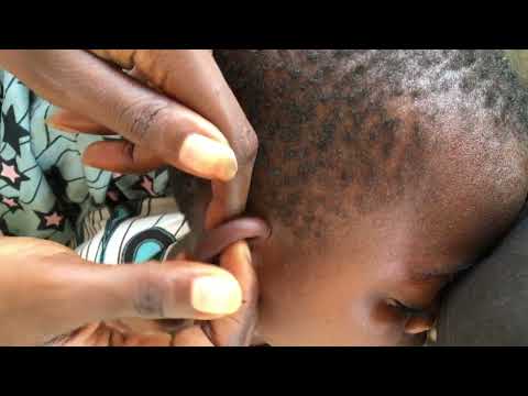 Asmr  Ear cleaning and gentle touching preauricular pit  for a satisfying sleep #asmr #earcleaning