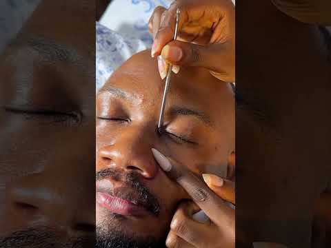 Asmr beards nitpicking pampering your man, pimple popping #relax