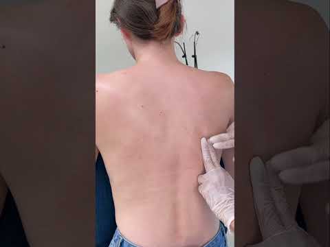 Asmr back exam #asmr #asmrsounds #asmrvideo #relaxing #relax #satisfying #satisfyingvideo #tingles