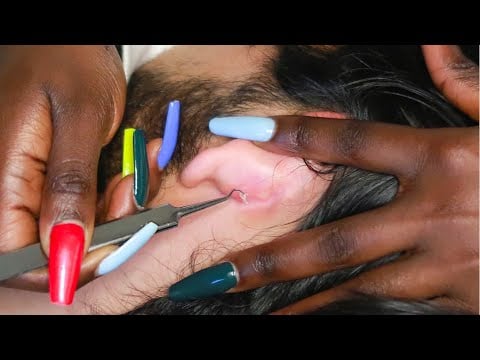 ASMR | Nitpicking Ultra rare & Random Places.