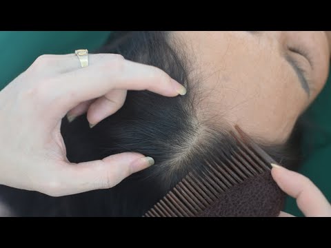 ASMR Aggressive Head Scratch, Hair Scratching, Therapy Sounds For Reduce Stress