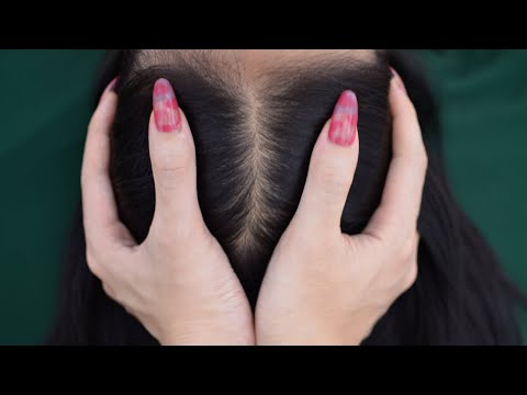 ASMR Head Scratching, Head Massage Fast And Aggressive For Headache Relief ( No Talking )