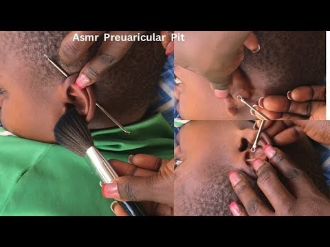 Preauricular Pit Asmr/ Super Attentive Asmr For Those Who Want To Sleep #satisfying