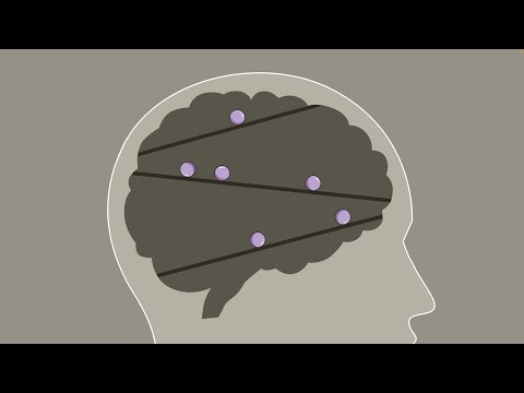 𝗔𝗦𝗠𝗥 팅글멍 때리기