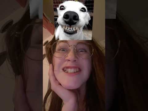 lol