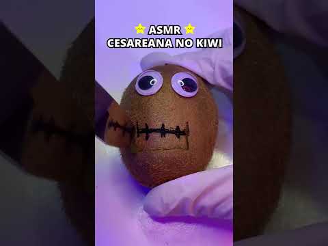 ASMR CESAREANA NO KIWI #shorts