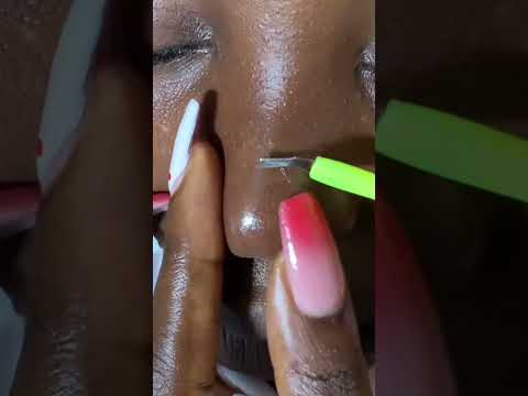 Deep Sleep ASMR - Ear Cleaning, Scalp Scratching, face picking Back Massage & Intense Triggers