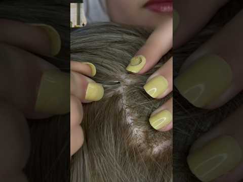 Scalp Check 💆🏻‍♀️ #asmr #satisfying #visualtingle #asmrmassage #relax #tingles #shorts