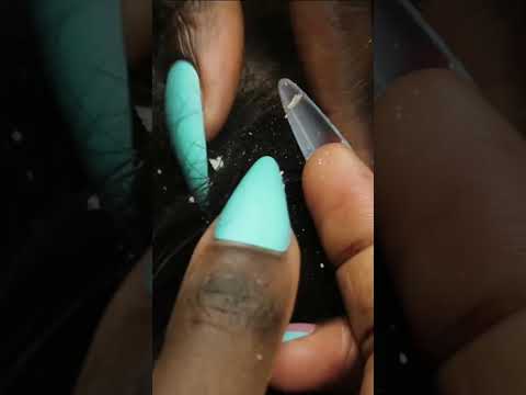 The craziest ASMR scratch | full video 👉🏽 https://youtu.be/bpChvadhjuU #shorts #shortsfeed #viral