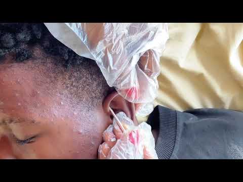 Asmr How To Clean and Nitpick The Ears