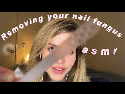 ASMR | Let Me Remove Your Nail Fungus