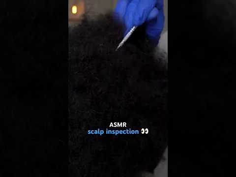 i found something on your scalp 🔎