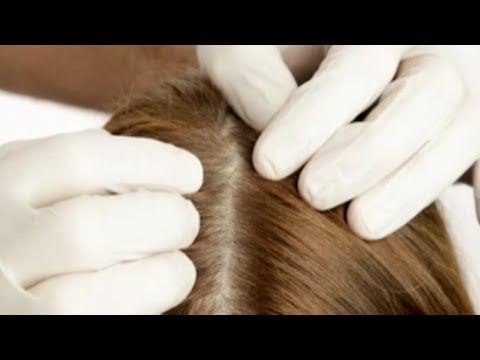 Asmr SCALP EXAM/Scratching 