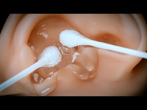 [ASMR] Cotton swab ear cleaning using clear lotion (High sound pressure, Sub)