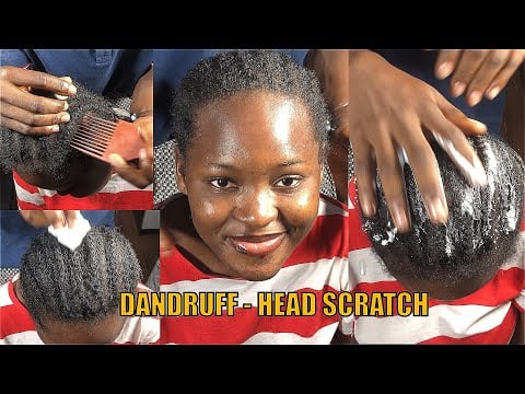 Aggressive Dandruff Removal + Hair Brushing & Scalp Scratching ASMR