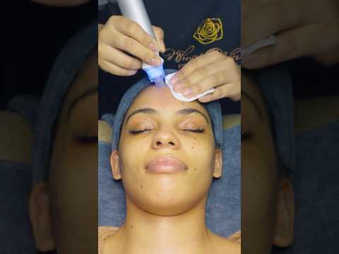 ASMR: Relaxing Acne Removal Treatment | Facial Massage in Vietnam #shorts