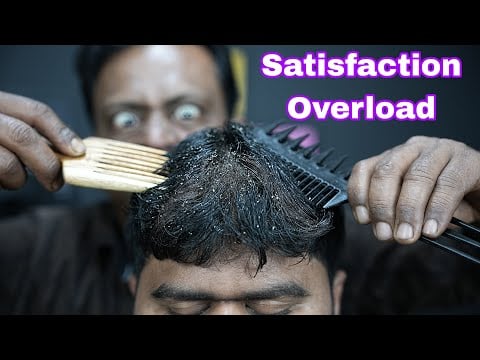 ASMR Satisfying Dandruff Removal From Dry Sculp | Dandruff Scratching ASMR | Dandruff Treatment ASMR