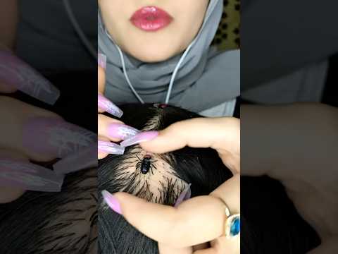 Bugs&Lice Removing 🐜💆🏻‍♀️😱 #asmr #satisfying #visualtingle #shorts #asmrmassage #scratching