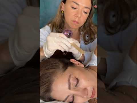 Asmr scalp tingles #asmr #asmrsounds #asmrvideo #relax #relaxing #satisfying #hair #sleep #tingles