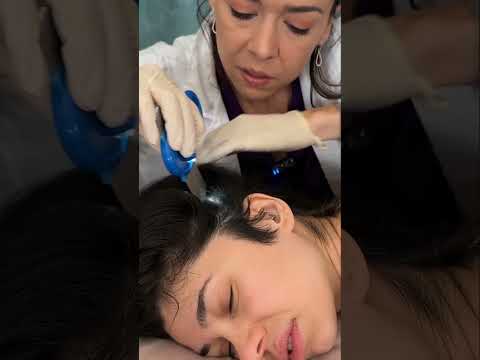Asmr scalp tingles #asmr #asmrsounds #asmrvideo #relax #relaxing #satisfying #hair #sleep #tingles
