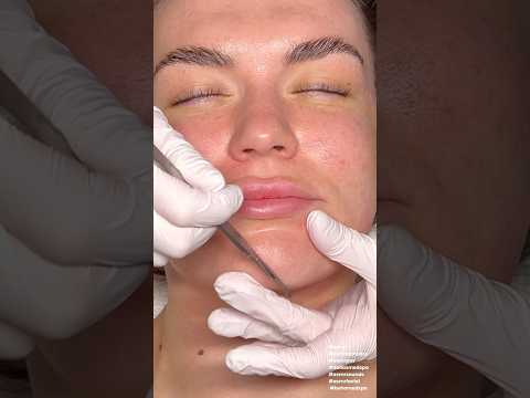 ASMR Dermaplaning