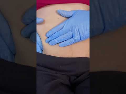 Belly Exam ASMR #asmr #roleplay #foryoupage Not a real Dr- fictional Roleplay