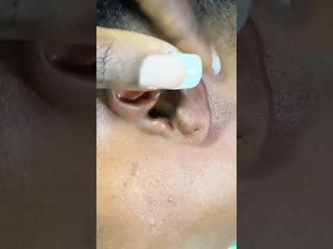 EAR PICKING & CLEANING #asmr #relaxation #tingling #earcleaning