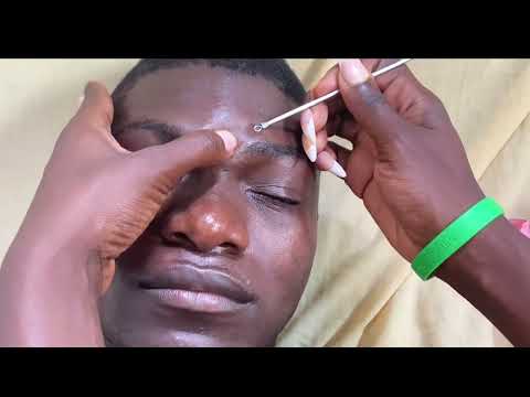 Asmr FACE NITPICKING AND CLEANING FOR THOSE WHO WANT TO SLEEP/RELAXING ASMR