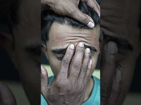 Migraine Relief ASMR: Head Massage for Instant Pain Reduction #shorts