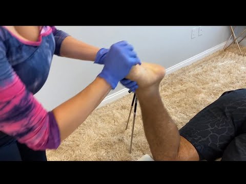 Clearing out HUGE KNOTS in the LEGs and Back