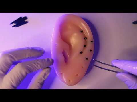 ASMR | Extração de CRAVOS para o SONO PROFUNDO
