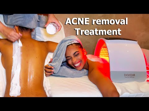 ASMR: I Tried a BACK ACNE Treatment Massage in Malaysia!